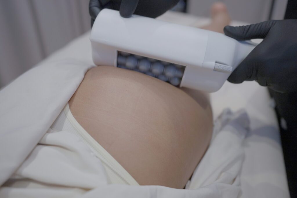 Close-up of Emsculpt NEO applicator being placed on a client's buttocks for body contouring at Modern Woman Med Spa Santa Rosa